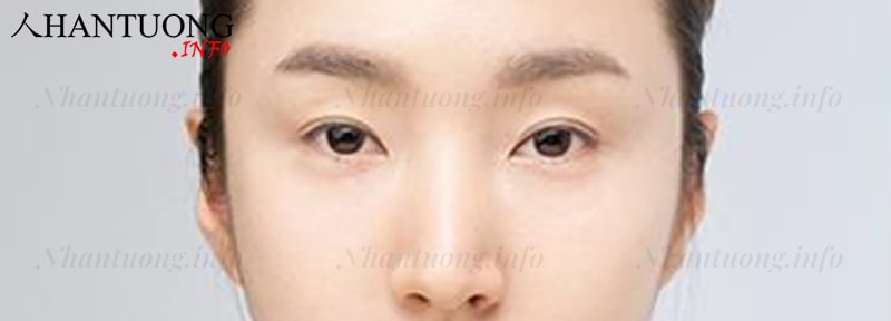 Dáng mắt ngắn Dáng mắt ngắn